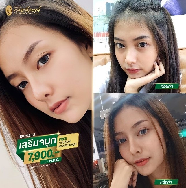 โรงพยาบาลเลอลักษณ์
